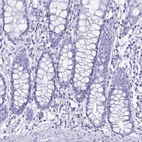 Immunohistochemical staining of human colon shows low expression as expected.