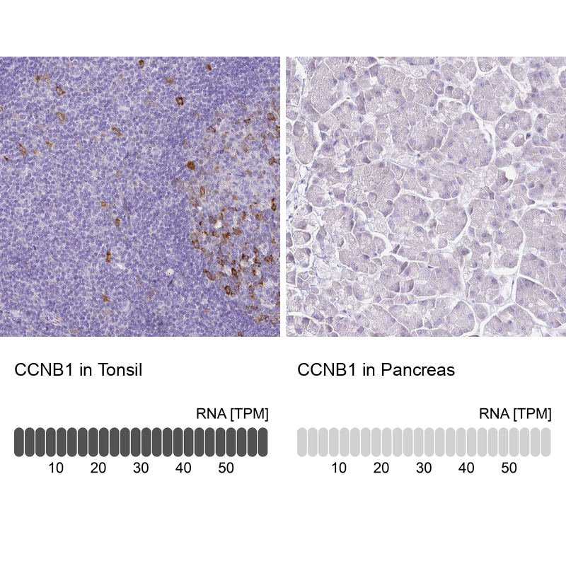 Anti-CCNB1 Antibody