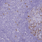 Anti-CCNB1 Antibody