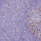 Immunohistochemical staining of human tonsil shows moderate cytoplasmic positivity in non-germinal center cells and germinal center cells.