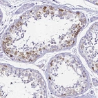 Immunohistochemical staining of human testis shows strong cytoplasmic/membranous positivity in cells in seminiferous ducts.