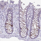 Immunohistochemical staining of human colon shows moderate cytoplasmic/membranous positivity in glandular cells.