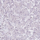 Immunohistochemical staining of human pancreas shows no positivity in exocrine glandular cells as expected.