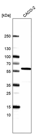 Western blot analysis in human cell line CACO-2.