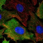 Immunofluorescent staining of human cell line A549 shows localization to cytosol.