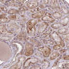 Anti-SEC62 Antibody