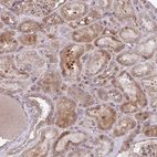Immunohistochemical staining of human kidney shows moderate granular cytoplasmic positivity in cells in tubules.