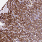 Anti-SEC62 Antibody