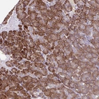 Immunohistochemical staining of human pancreas shows moderate granular cytoplasmic positivity in exocrine glandular cells.