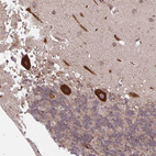 Immunohistochemical staining of human cerebellum shows strong granular cytoplasmic positivity in Purkinje cells.