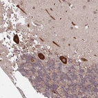 Immunohistochemical staining of human cerebellum shows strong granular cytoplasmic positivity in Purkinje cells.