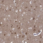 Anti-TARBP2 Antibody