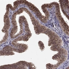 Immunohistochemical staining of human fallopian tube shows high expression.