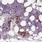 Immunohistochemical staining of human bone marrow shows strong cytoplasmic positivity in hematopoietic cells.