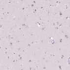 Immunohistochemical staining of human cerebral cortex shows no positivity in neurons as expected.