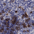 Anti-KIF15 Antibody