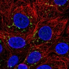 Immunofluorescent staining of human cell line MCF7 shows localization to the Golgi apparatus.