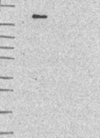 Lane 1: Marker [kDa] 250, 130, 95, 72, 55, 36, 28, 17, 10 | Lane 2: RT4 | Lane 3: U-251 MG | Lane 4: Human Plasma | Lane 5: Liver | Lane 6: Tonsil