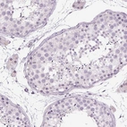Immunohistochemical staining of human testis shows no positivity in cells in seminiferous ducts as expected.