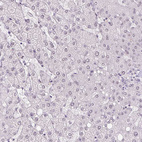 Anti-MPO Antibody