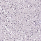 Immunohistochemical staining of human liver shows no positivity in hepatocytes as expected.