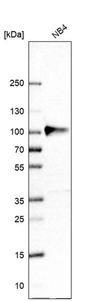 Western blot analysis in human cell line NB4.