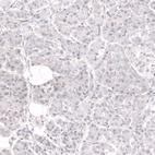 Anti-BCOR Antibody