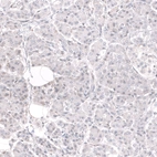 Immunohistochemical staining of human pancreas shows no positivity in exocrine glandular cells as expected.