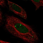 Immunofluorescent staining of human cell line SiHa shows localization to nucleus & vesicles.