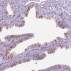 Anti-TTC29 Antibody