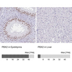 Anti-PBX2 Antibody