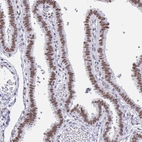 Immunohistochemical staining of human Fallopian tube shows strong nuclear positivity in glandular cells.