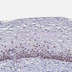 Immunohistochemical staining of human cervix shows moderate nuclear positivity in squamous epithelial cells.