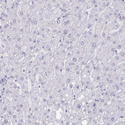 Immunohistochemical staining of human liver shows no positivity in hepatocytes as expected.
