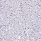 Immunohistochemical staining of human liver shows no positivity in hepatocytes as expected.