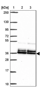 Lane 1: Marker [kDa] 250, 130, 95, 72, 55, 36, 28, 17, 10_br/_Lane 2: Human cell line RT-4_br/_Lane 3: Human cell line U-251MG sp