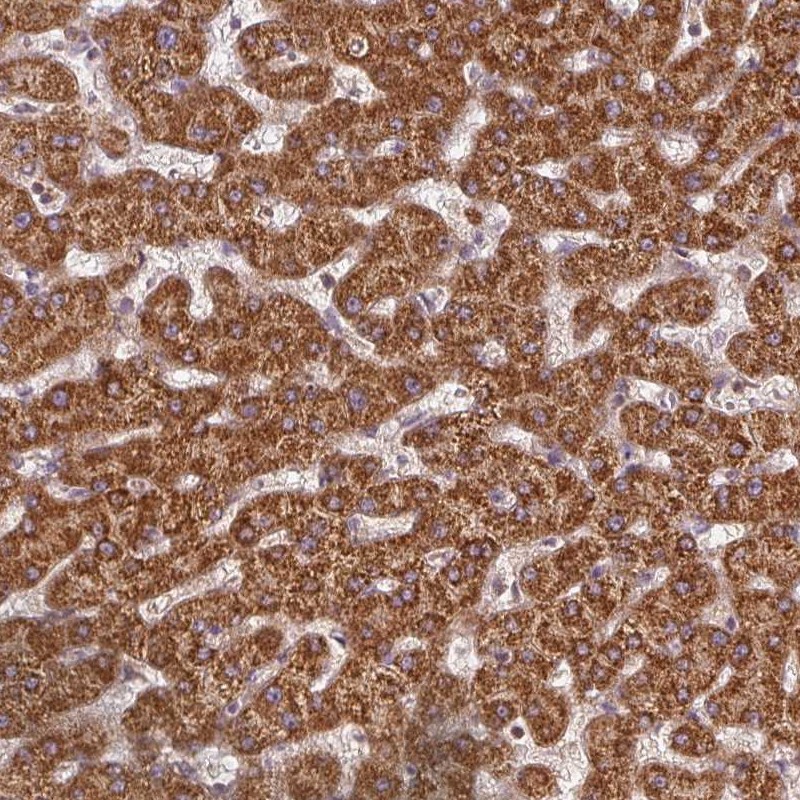 Anti-NADK2 Antibody