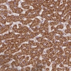 Anti-NADK2 Antibody