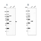 Western blot analysis using Anti-NADK2 antibody HPA061492 (A) shows similar pattern to independent antibody HPA038366 (B).