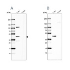 Anti-NADK2 Antibody