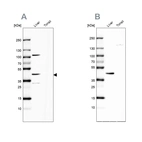 Western blot analysis using Anti-NADK2 antibody HPA061492 (A) shows similar pattern to independent antibody HPA038366 (B).