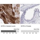 Anti-MYPN Antibody