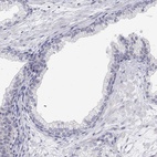 Immunohistochemical staining of human prostate shows low expression as expected.