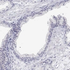 Immunohistochemical staining of human prostate shows low expression as expected.