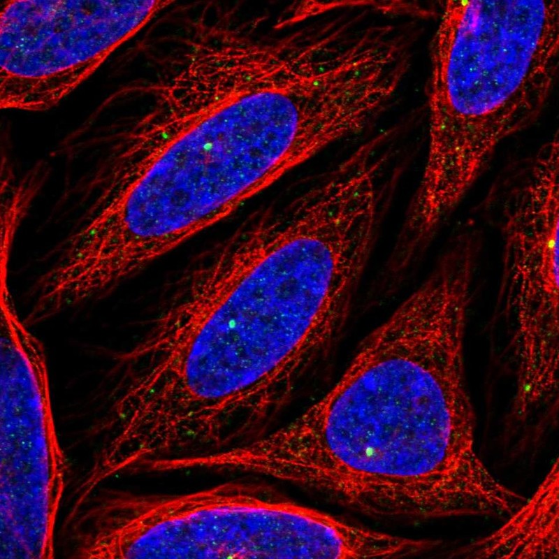 Anti-CEP164 Antibody