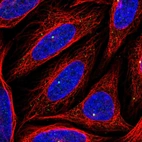 Anti-CEP164 Antibody