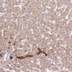 Anti-ARHGAP32 Antibody