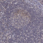 Anti-ALKBH8 Antibody