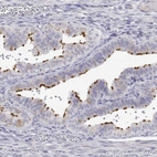 Immunohistochemical staining of human fallopian tube shows high expression.
