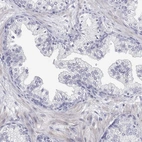 Immunohistochemical staining of human prostate shows low expression as expected.